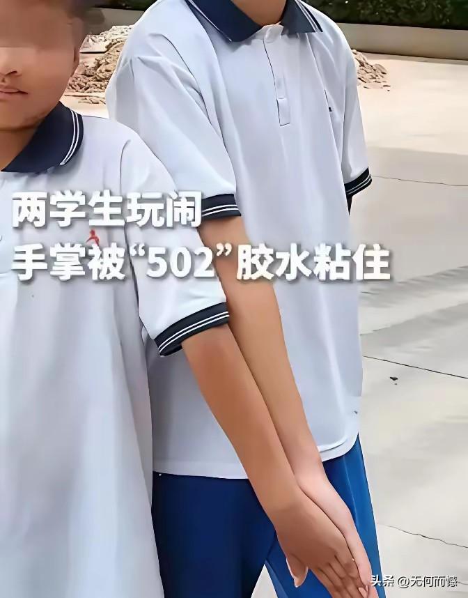 两个学生玩闹，结果两个的手被502胶死死的粘在了一起，到了医院之后，医生都不敢接