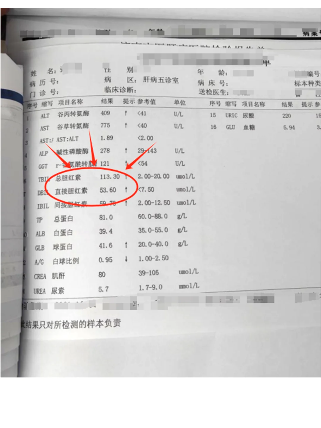 肝功能这个指标高起来可真受罪啊，一定重视