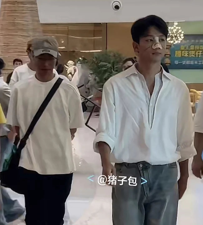 张晚意鼻子受伤张晚意鼻子受伤了！哥也太低调敬业了…疑似张晚意鼻子受伤早日康复！期