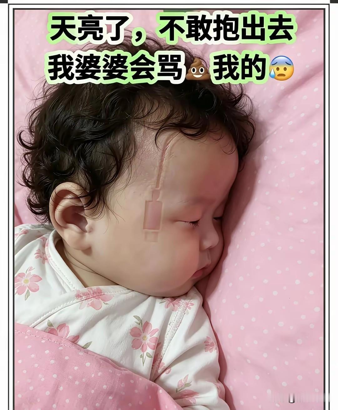 看到这张照片，就想笑！
小朋友被“充了多长时间的电”，才能在脸上留下这个痕迹？他