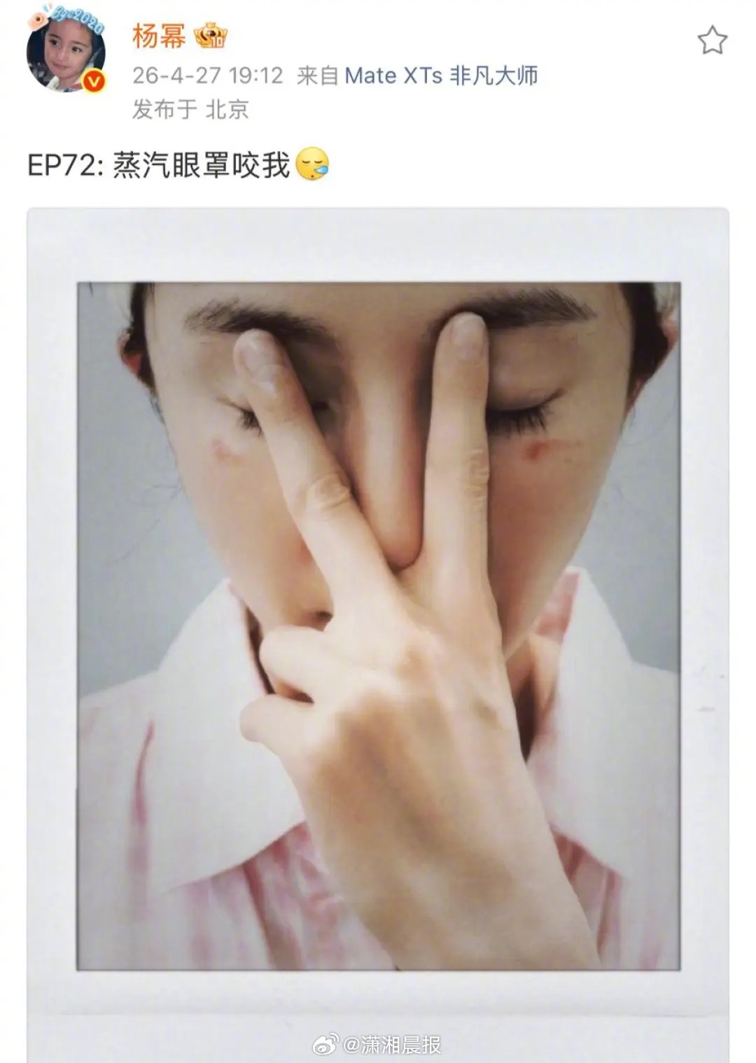 【#专家称蒸汽眼罩50度可致低温烫伤#，#专家称眼部皮肤易成低温烫伤重灾区#】#