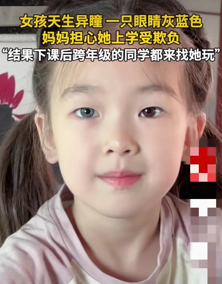 7岁异瞳女孩在学校受到同学喜爱，这3点真的太暖心了：


1.妈妈本来担心女儿在