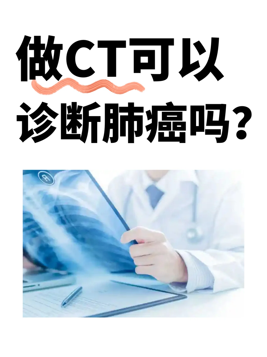做CT能诊断肺癌吗？