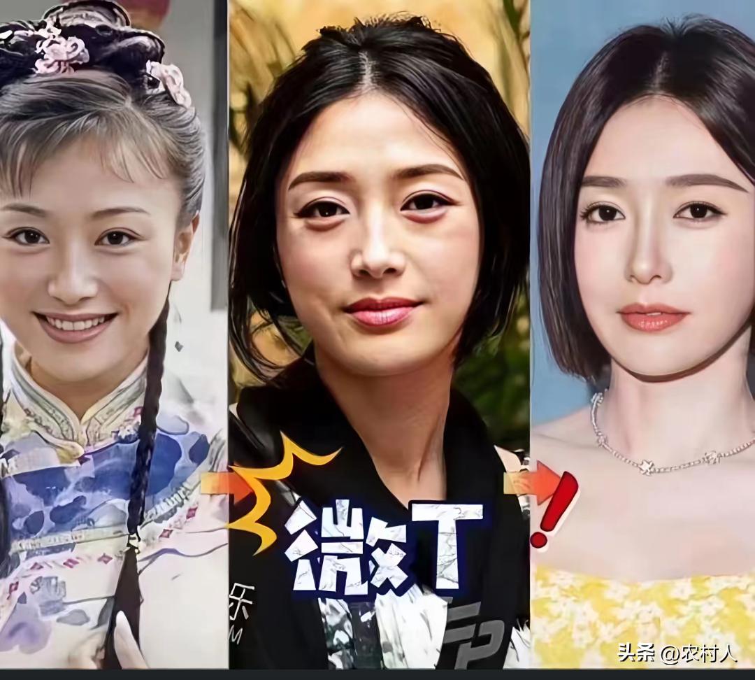 秦岚自爆：现在纯天然美女很少了，大部分都是整过容的。为了把自己变得更精致，长期往