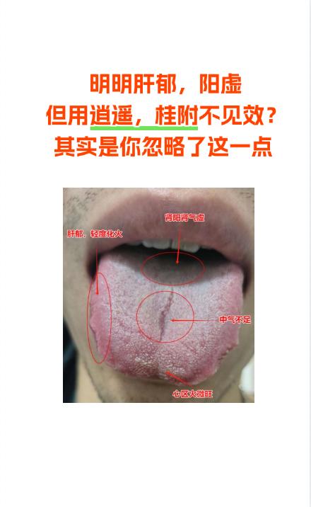 很多粉丝朋友，想让杨医生，帮忙看舌象，这当然是可以的啦！
你发我看，现场分析，出