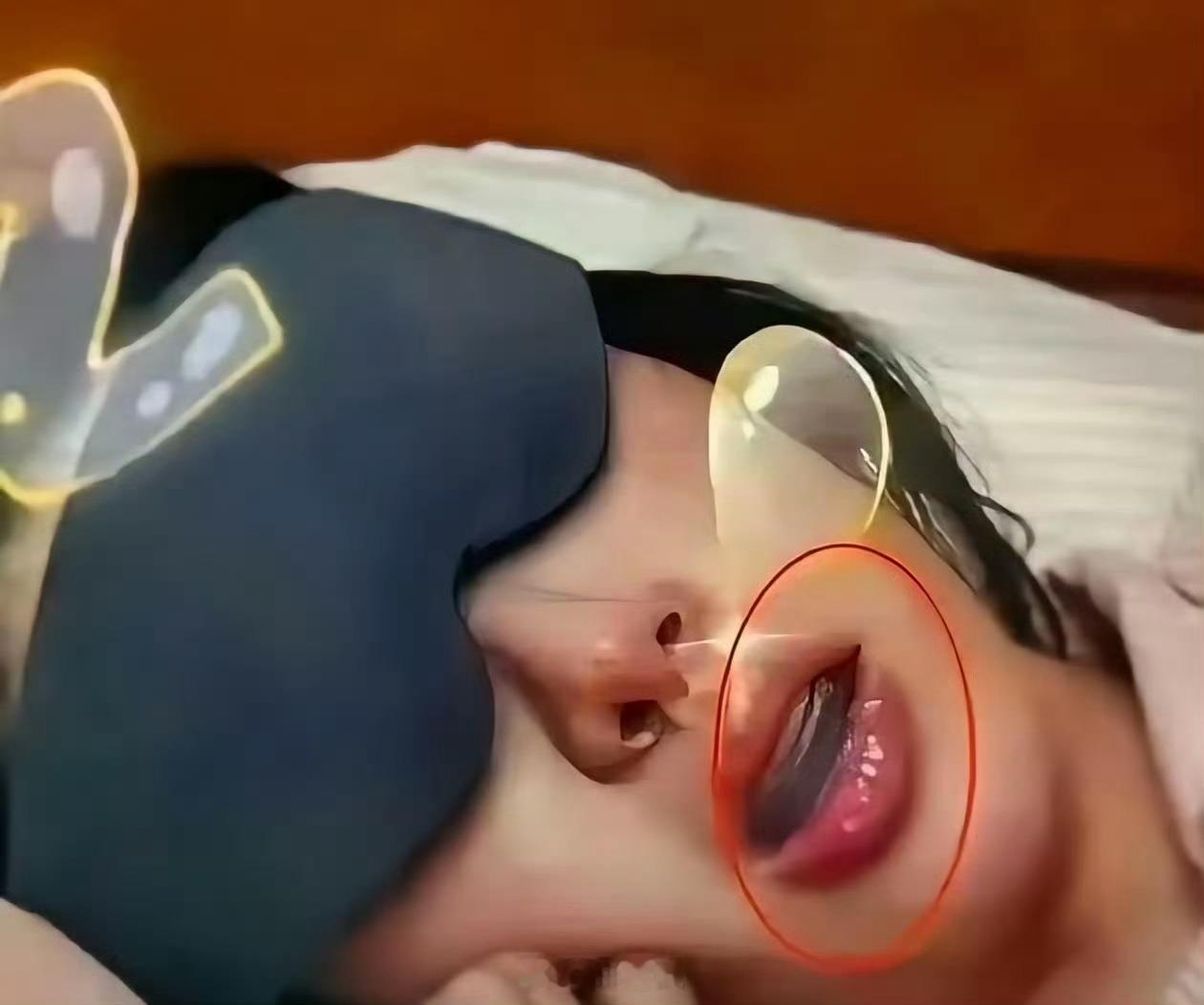 金晨为保持良好形象，连睡觉时鼻子和嘴巴都带着保持器 