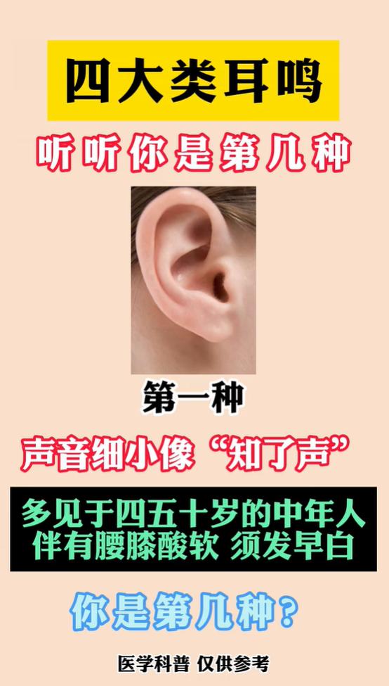 耳朵持续作响？四种耳鸣类型，看看你属于哪一类？