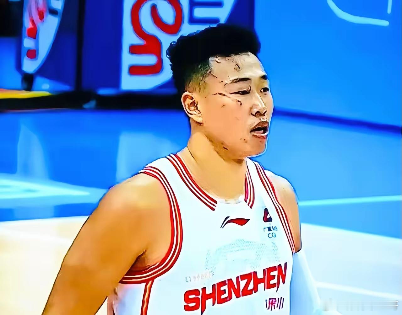 CBA 贺希宁的脸印证了那句话：cba强度确实比nba大贺希宁回应挂彩CBA