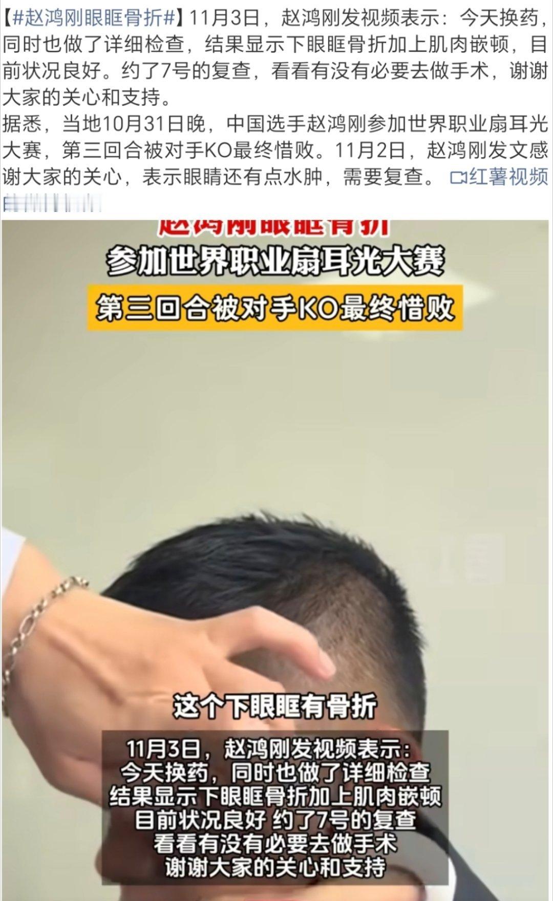 赵鸿刚眼眶骨折还有这种比赛啊甚至都不是业余 是职业扇耳光大赛真是闻所未闻[泪奔]