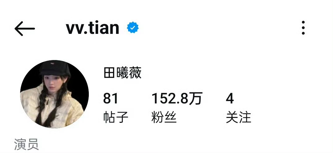 #田曦薇关注了沃齐尼亚##田曦薇点赞沃齐尼亚#这什么梦幻联动！田曦薇ins关注了