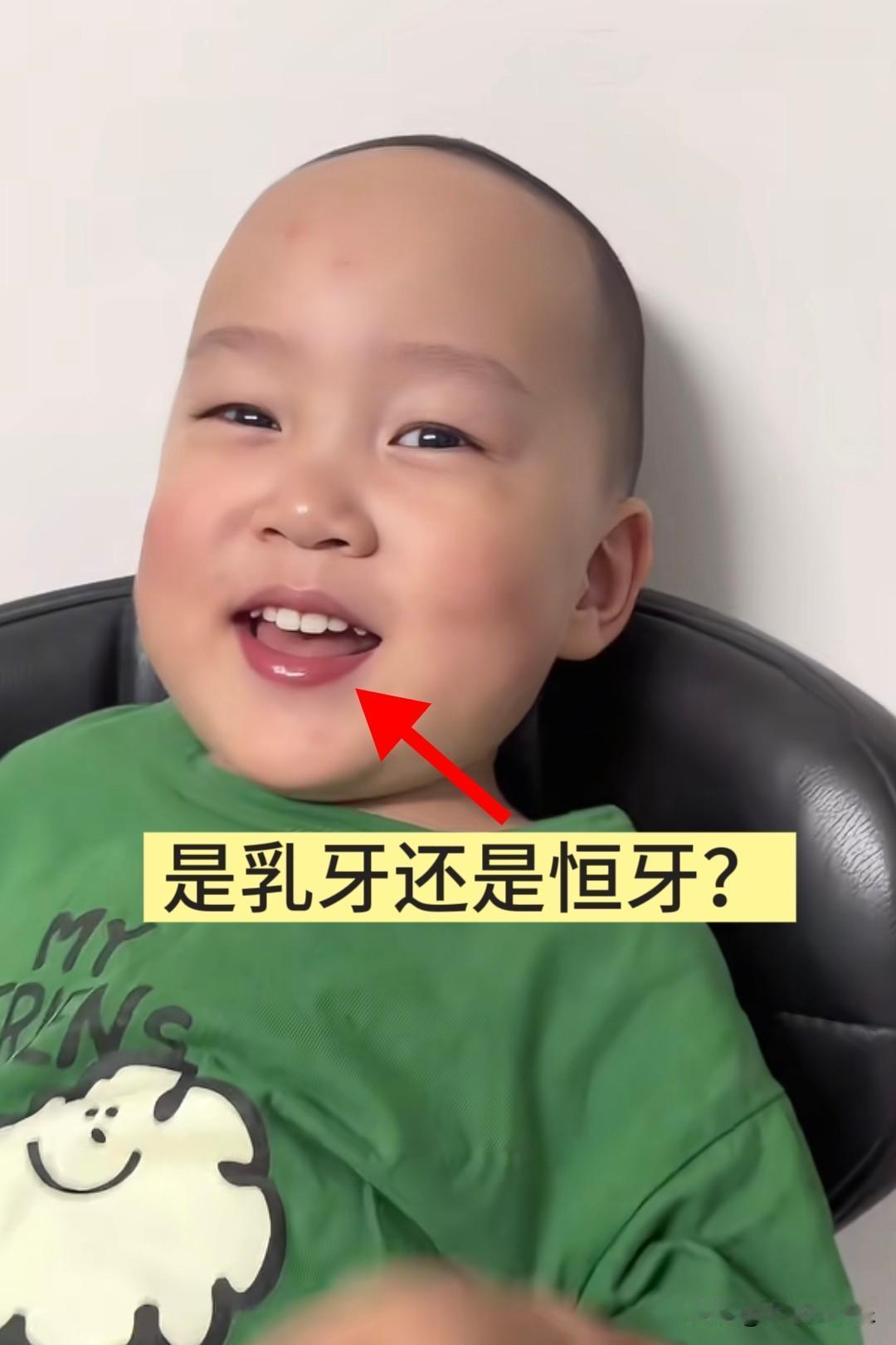 关于米乐的年龄，网友都吵翻了。

有说他今年两岁的，有说他牙齿一看就是换过乳牙，