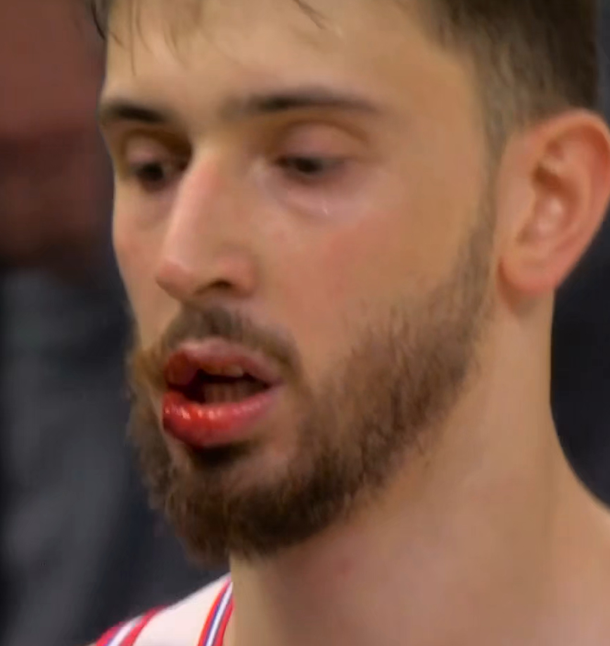 挖槽，申京这么硬。NBA