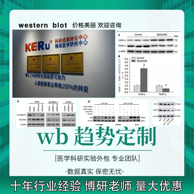 wb趋势，wb代做，wb实验wb趋势
专业，靠谱
博研老师，十年高校合作经验