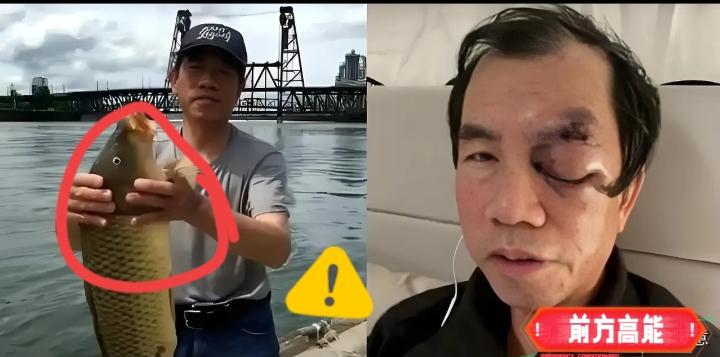 曾迷恋海外生活美好？
一场遇袭让老人幡然醒悟，现实太刺骨！

美国梦彻底破碎！七
