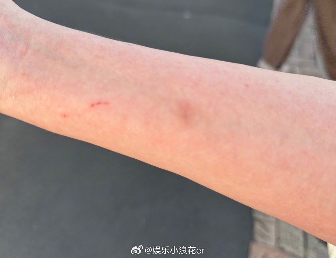 粉丝称被NCTWISH安保性骚扰曝NCTWISH安保性骚扰粉丝 有网友称，在参加