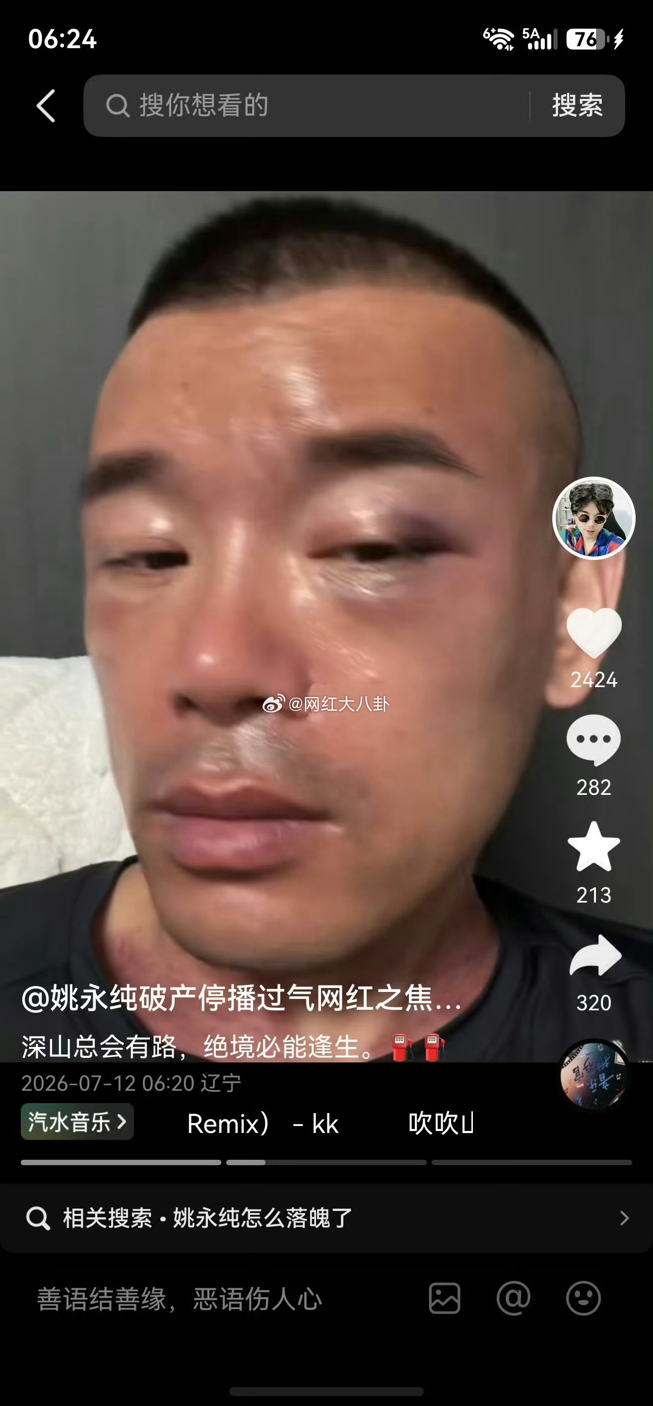 姚永纯现状很惨，最后因投资白银失败亏空家产，导致患上了严重焦虑症躯体化，到处寻医