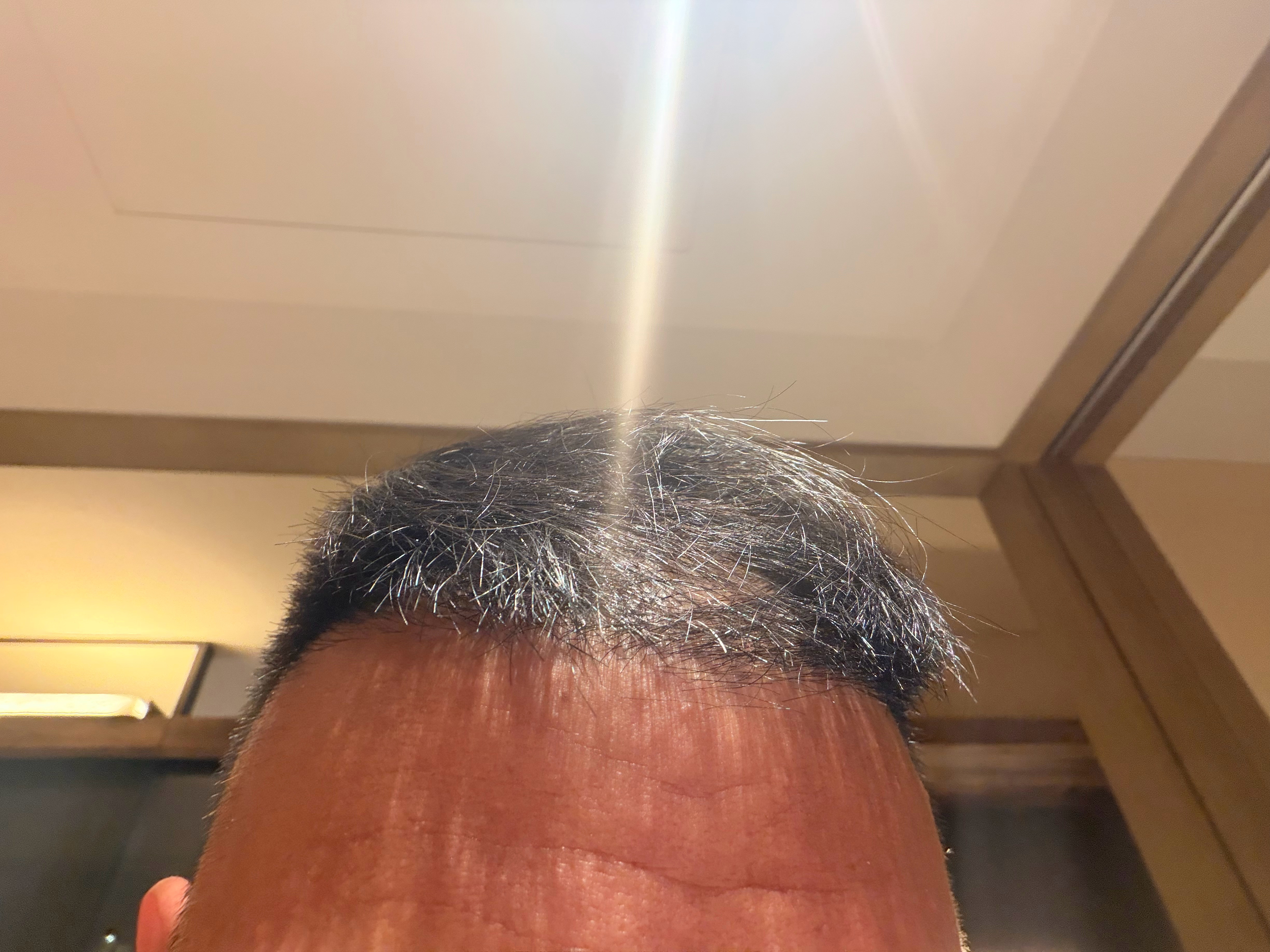 征集个Tony 中间少两边多帮我设计个牛逼的发型💇 