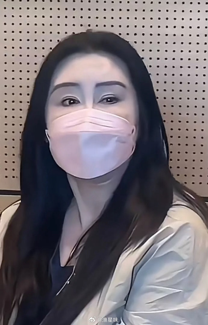 王祖贤力证，医美需谨慎 