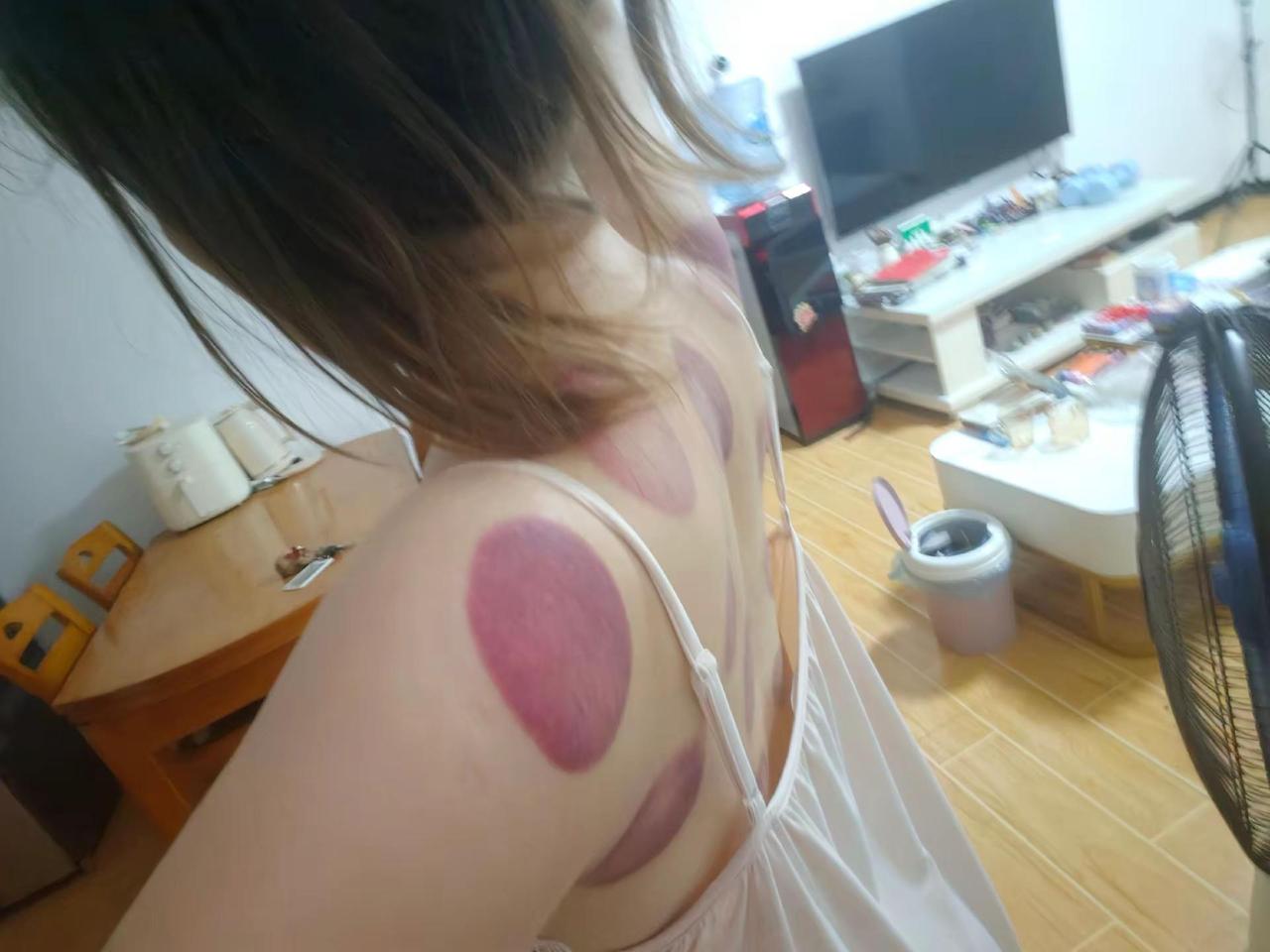 一身的烙印