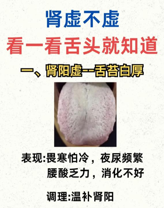 舌头看健康：肾气好不好一测便知