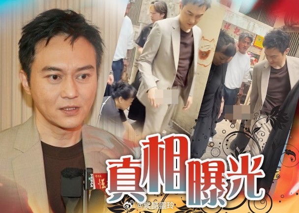 【On.cc】張智霖元朗被圍助手踎低整理褲腳　無視粉絲被指耍大牌？不老男神張智霖
