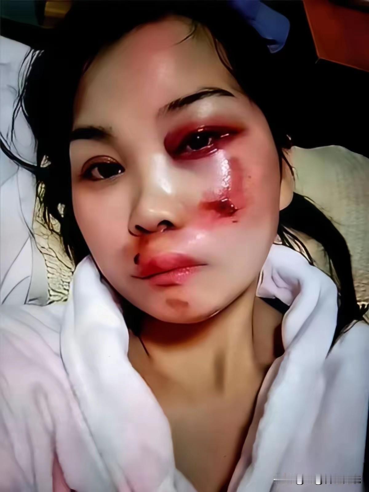 湖北襄阳的刘女士，这是要搬起石头砸自己的脚吗？
她公开发布了一个被家暴的视频，播