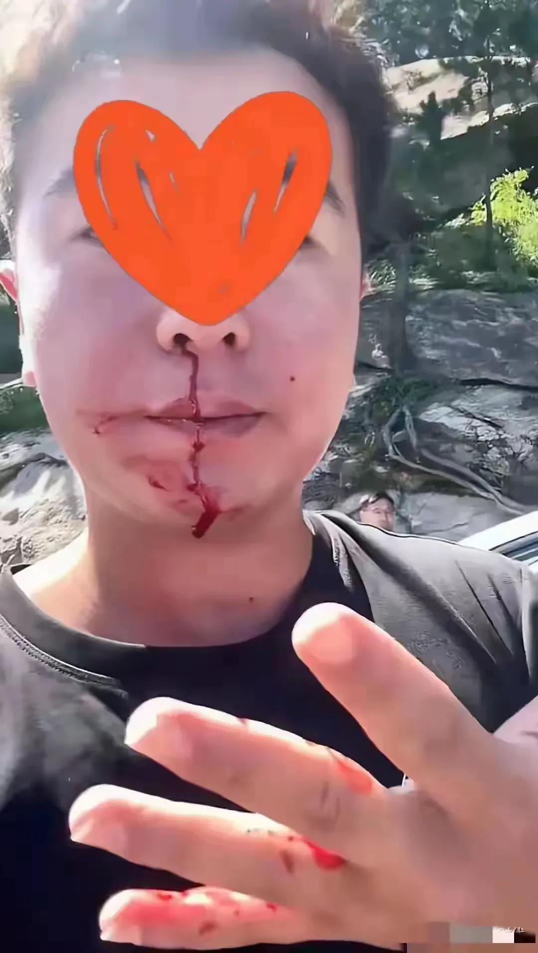 青岛崂山路虎女司机‬逆行、打人一事，随着警方的通报，我们也逐渐摸清了来龙去脉。