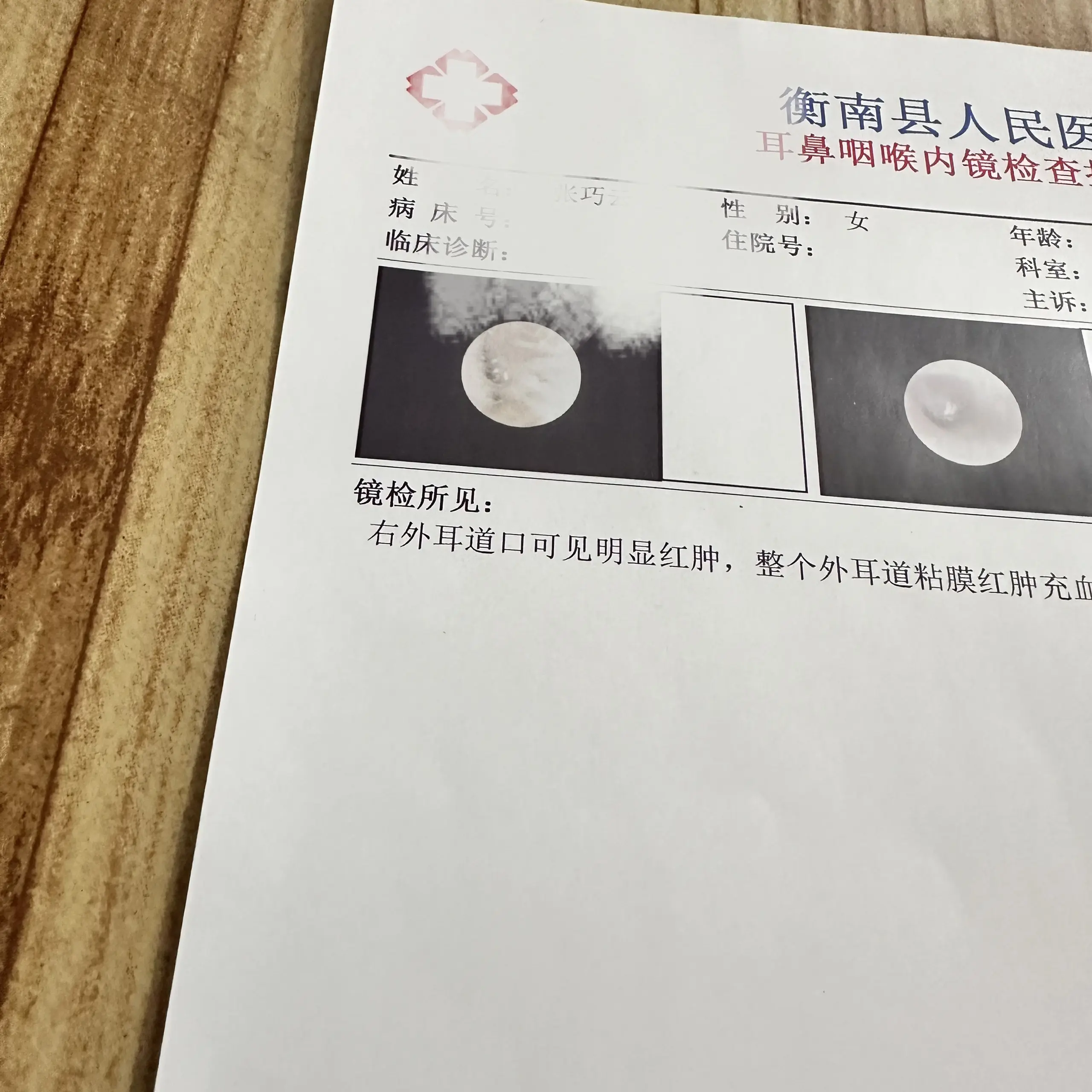 听不见，今天去县城看耳朵了！