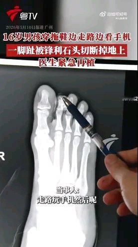 广州这16岁男生可真是太不小心了！边走路边看手机，还穿着人字拖，一脚踢上路边工地