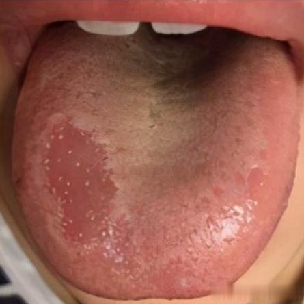 孩子脾气大、喜欢喝冷饮、大便干燥可能是阴虚火旺！看看你家孩子还有没有下列表现。
