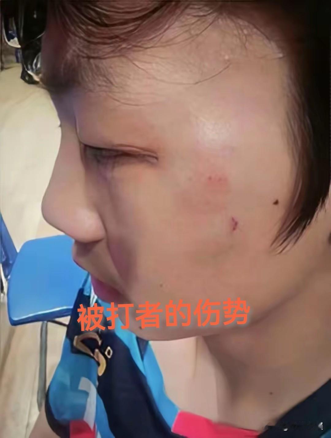 输球打人者名叫曹彦灏是国手曹彦涛的弟弟。曹彦灏和曹彦涛是原国手曹振东的儿子。
