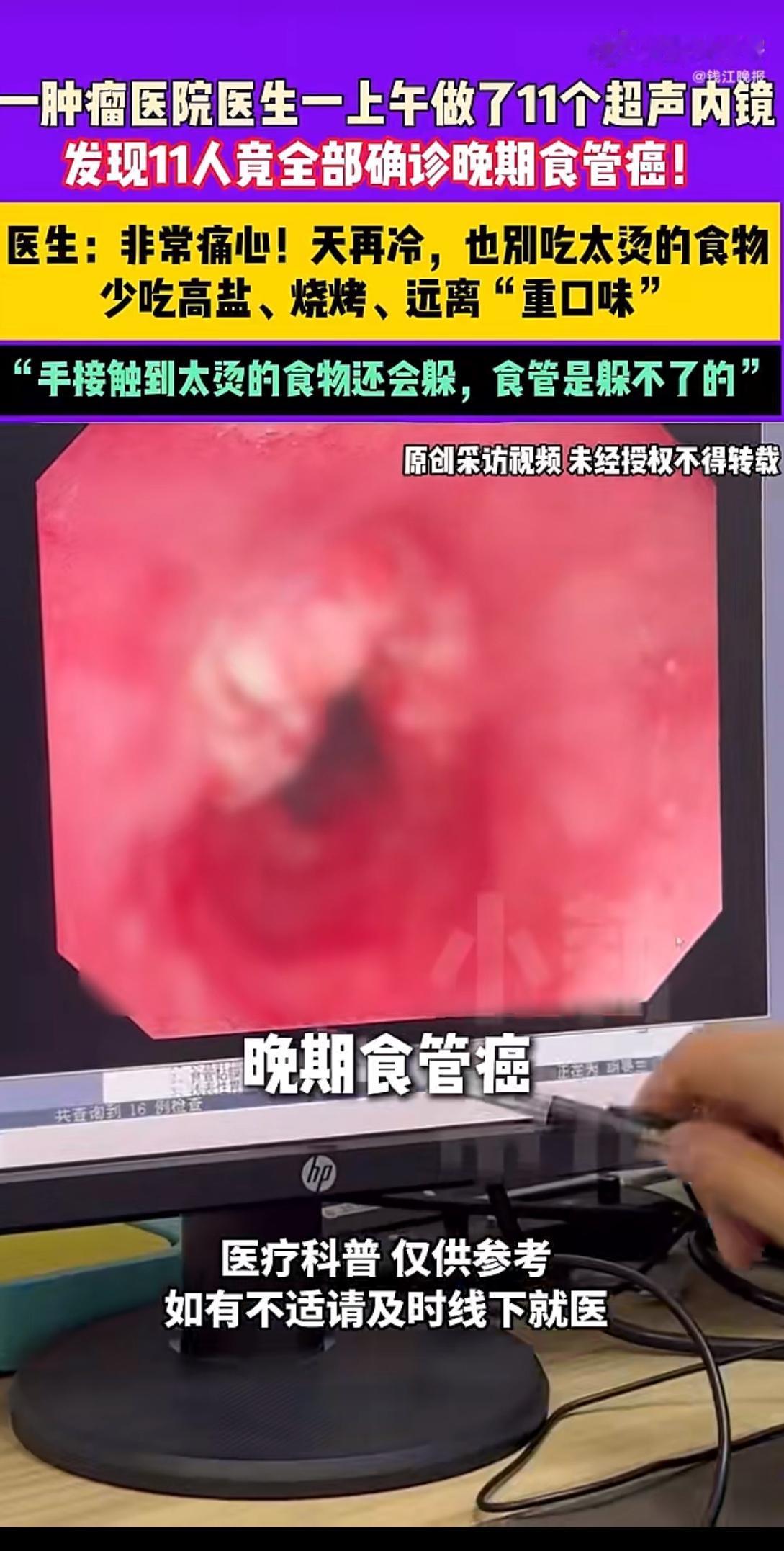 最近，河南郑州一家肿瘤医院里发生了一件让人揪心的事儿。一上午的时间，医生通过超声