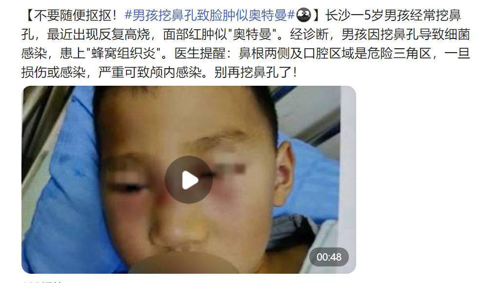 相信没有人在挖鼻子前，会想到清洗下自己的手指吧？挖鼻子的那只“金手指”，携带了