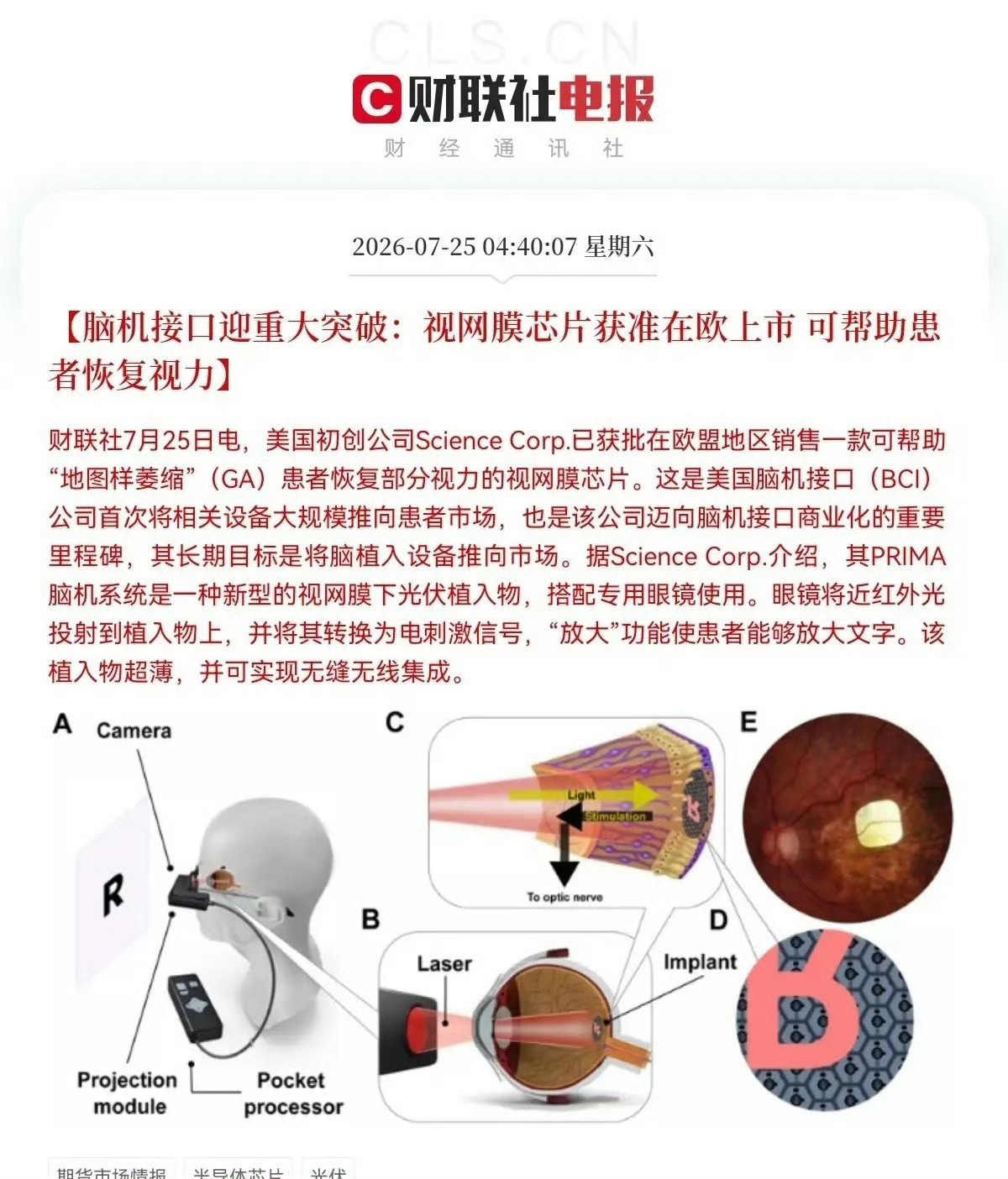 重大消息！重大消息！脑机接口迎来利好消息了，这下好了，满仓脑机接口的要乐开花了，