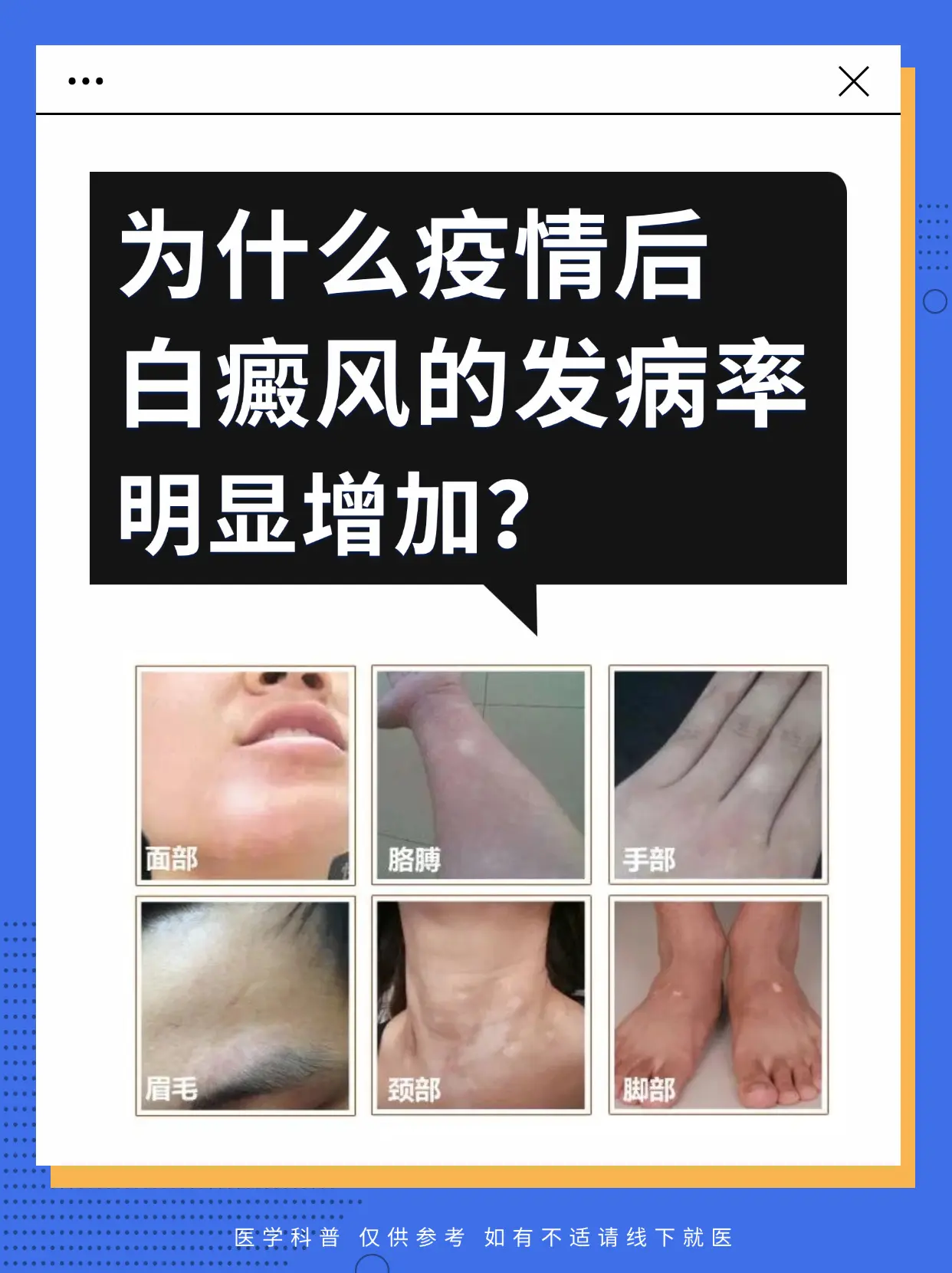 医学科普 白癜风 白癜风科普 抖出健康知识宝藏  白斑