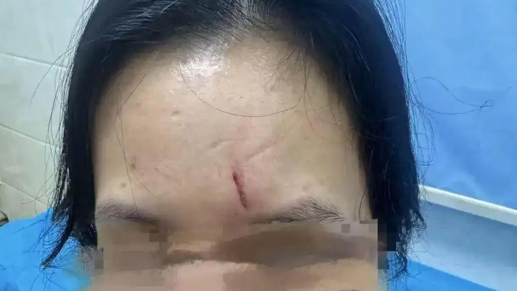 说真的去健身房花钱是为了健身结果花钱买了个伤。广州一位姑娘在乐刻健身上课的时候，