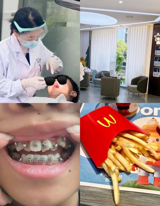 坐标杭州，暑假给老弟卷一下牙齿