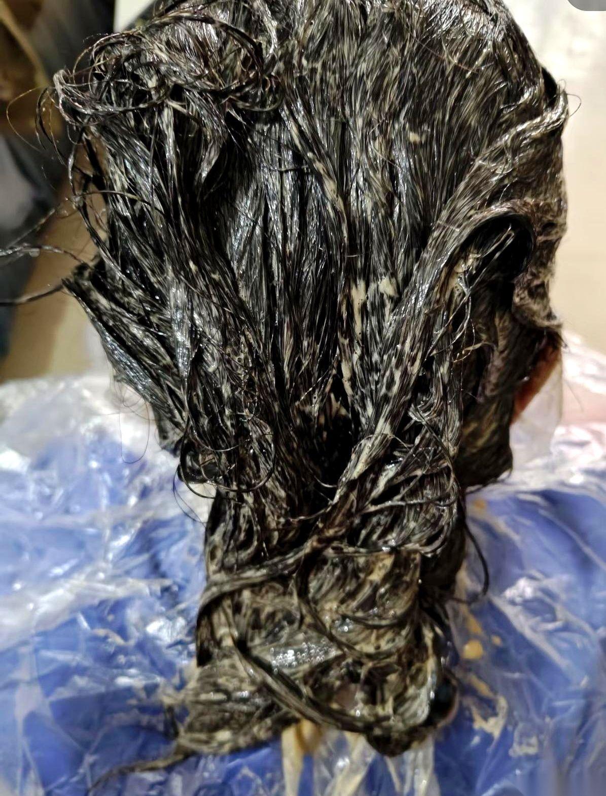 61岁的表嫂怎么也没想到，为了遮住两鬓那几根碍眼的白发，她硬生生把自己的肾给“染