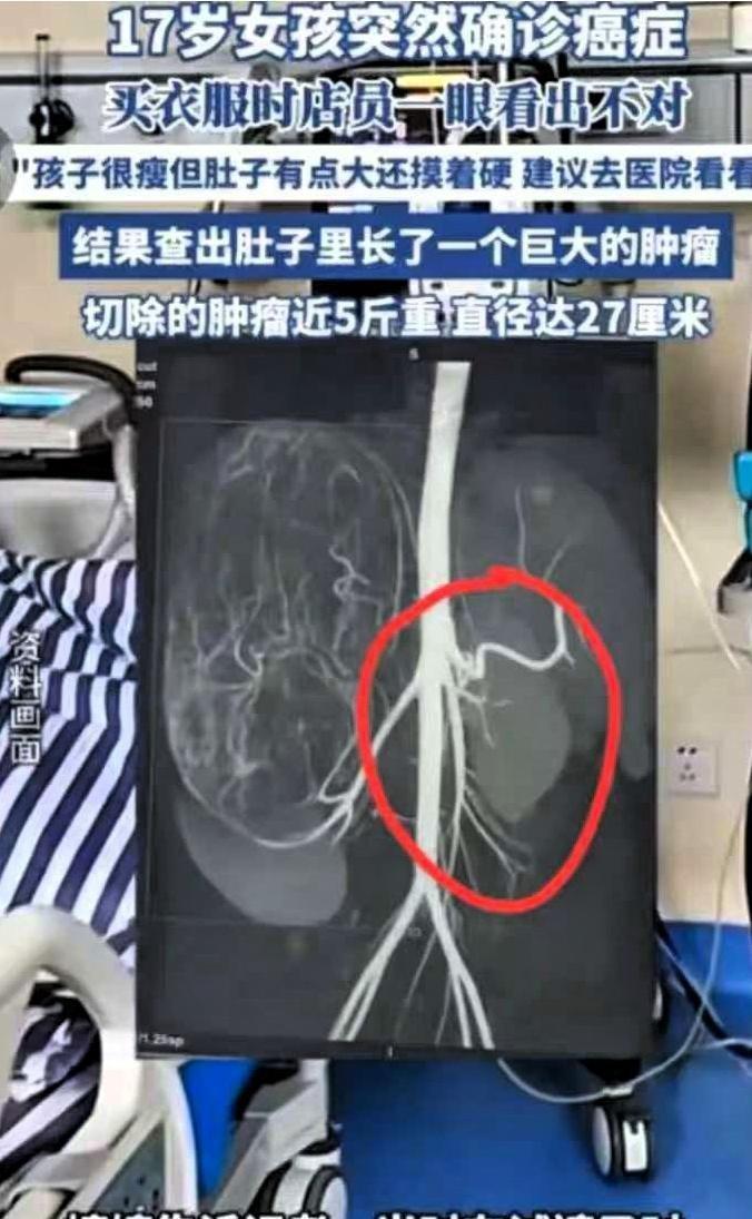 2025年6月，广东17岁女孩和妈妈一起逛街买衣服，在试裤子的时候，老板娘发觉女