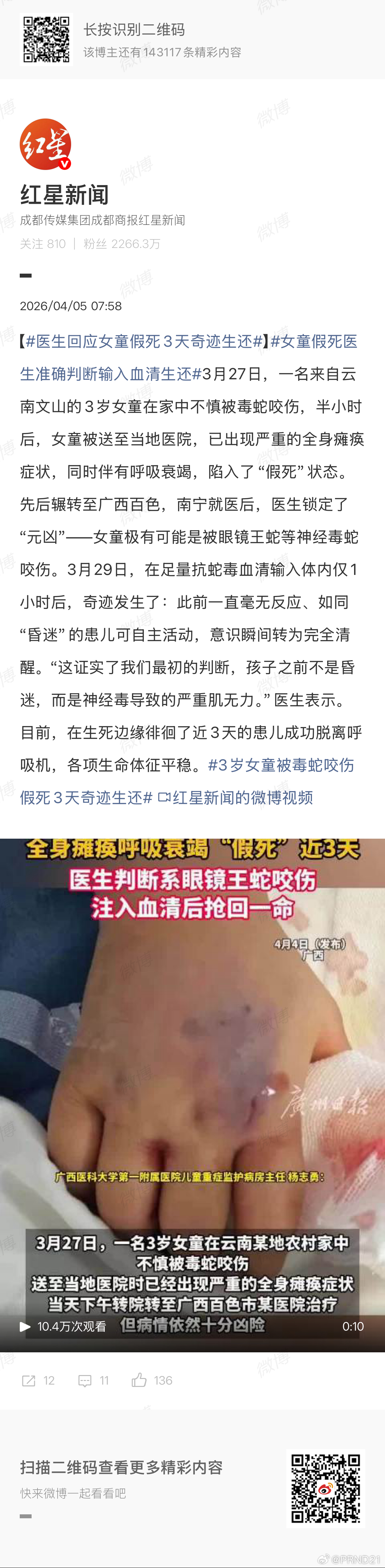 医生回应女童假死3天奇迹生还 这怎么就奇迹了，这是现代医学的力量啊…… 