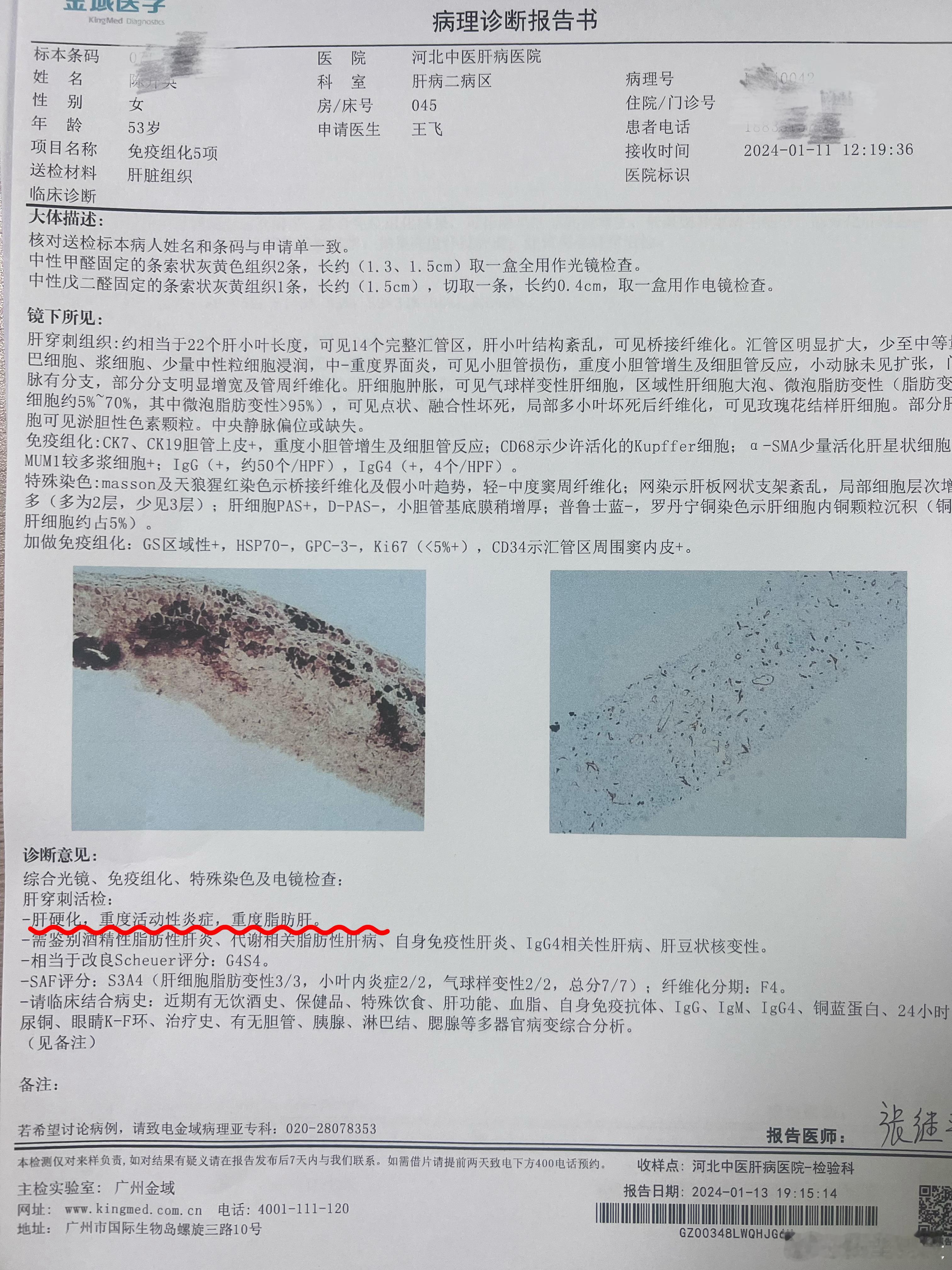 很多人觉得脂肪肝没事，不疼不痒也不难受，也有一部分人知道脂肪肝不好，也会发展，但