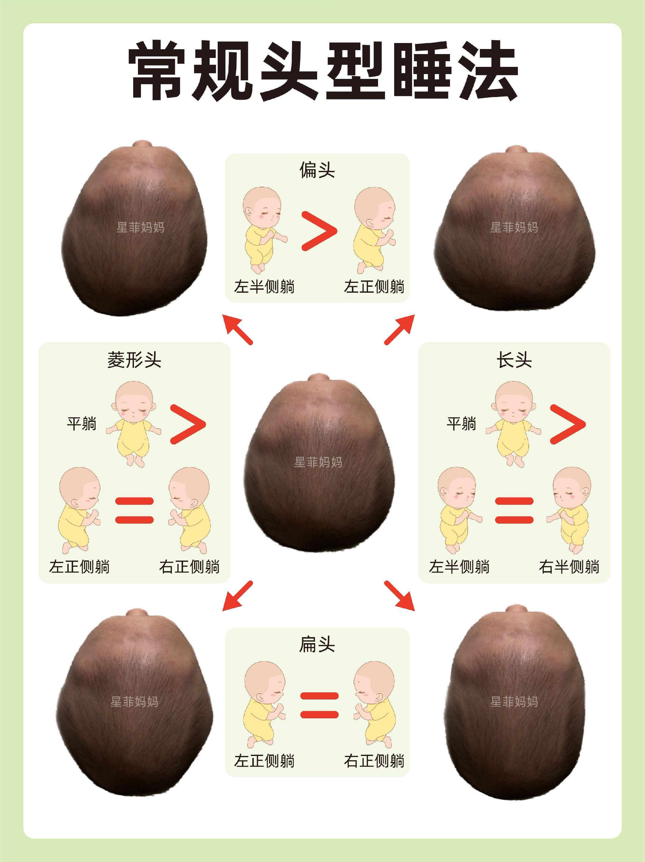 常规头型如何睡圆头！一篇讲明白。