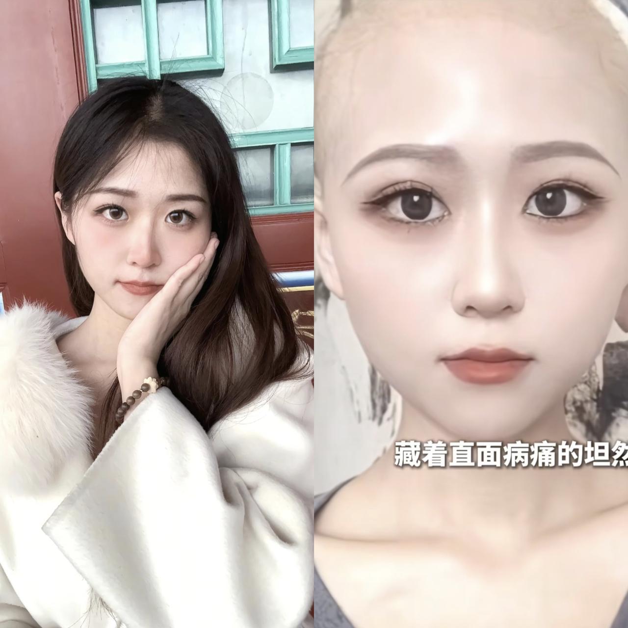 在去世的前一个月，也就是9月份的时候，27岁的医学博士悦悦，还透露了自己确诊乳腺