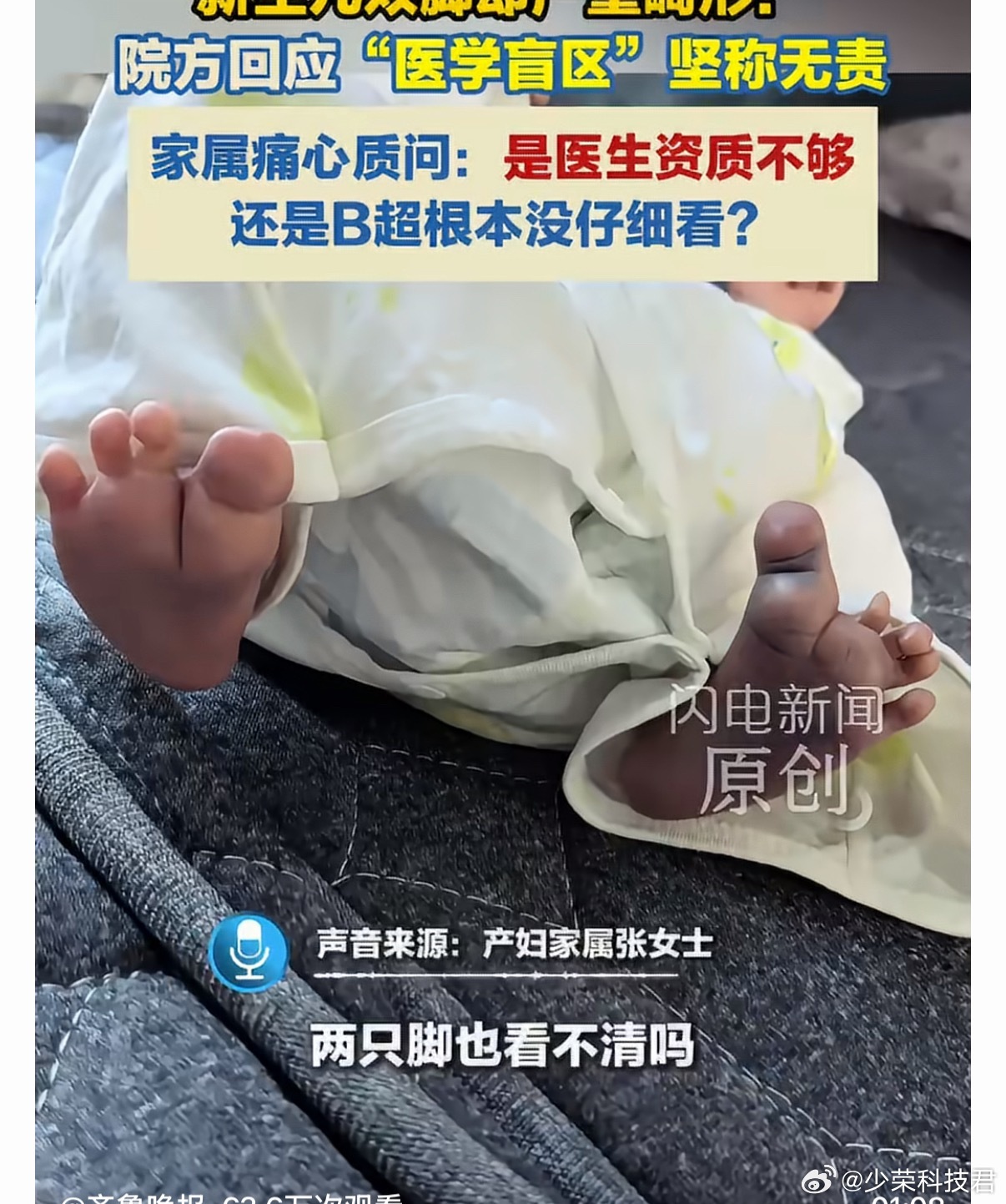 家属回应幼儿产检正常出生双脚畸形院方坚持认为该情况属于医学盲区，难以在产检中完全