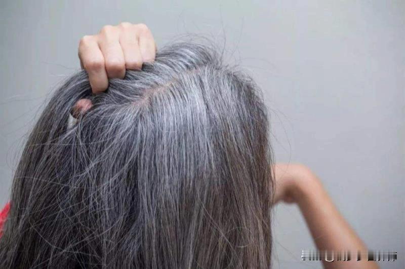 干枯、脱发、白发怎么办?
家人们！影视剧里“一夜白头”的桥段，到底是艺术夸张还是