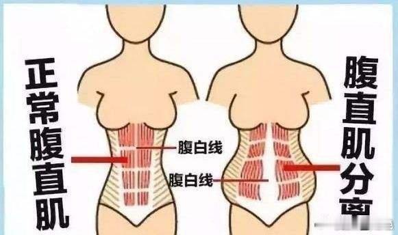 #女性生孩子的理由只有一个##女性可能面临的生育损伤# 我今天接待的一个会员，孩