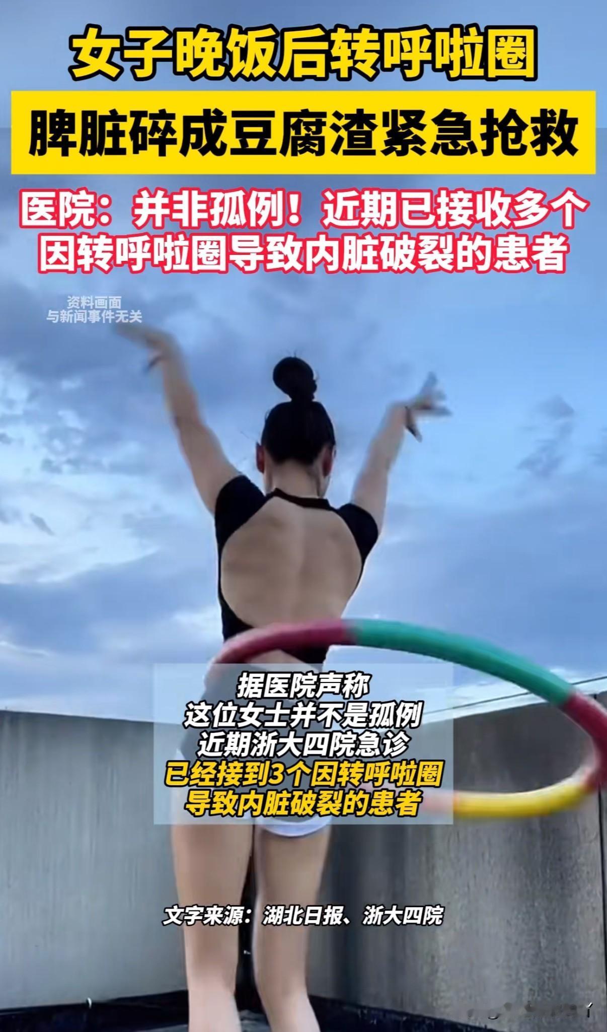 浙江医大深夜接诊一名女子脾脏碎成豆腐渣，原因竟是转呼啦圈导致

近日浙江大学第四