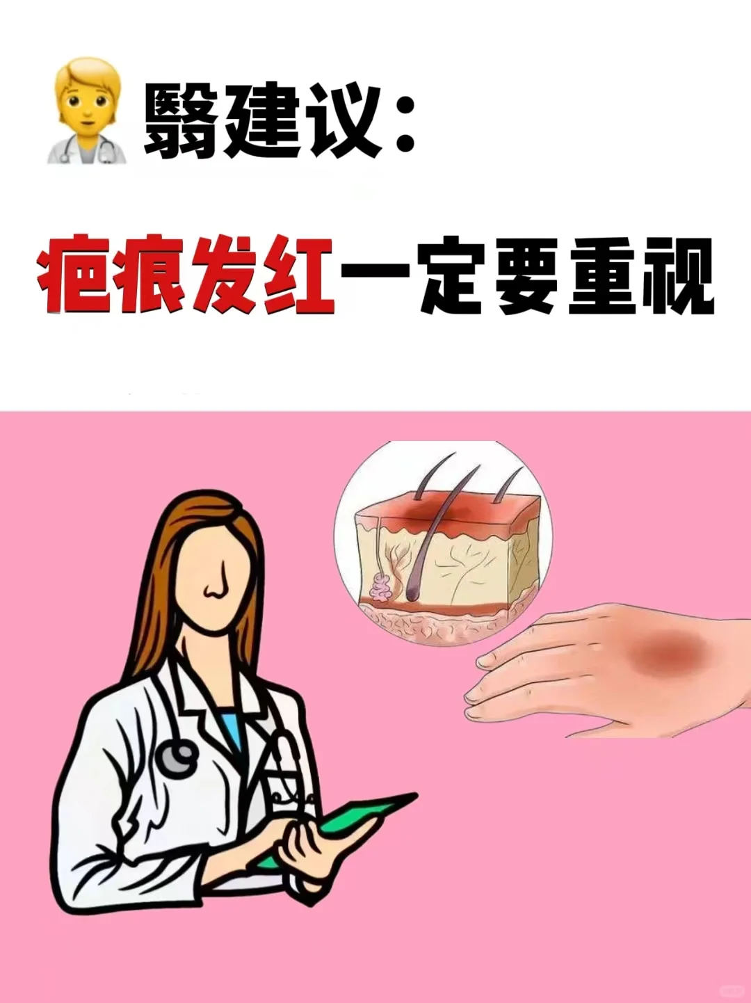疤痕发红如何正确处理🤔看这一篇就够了