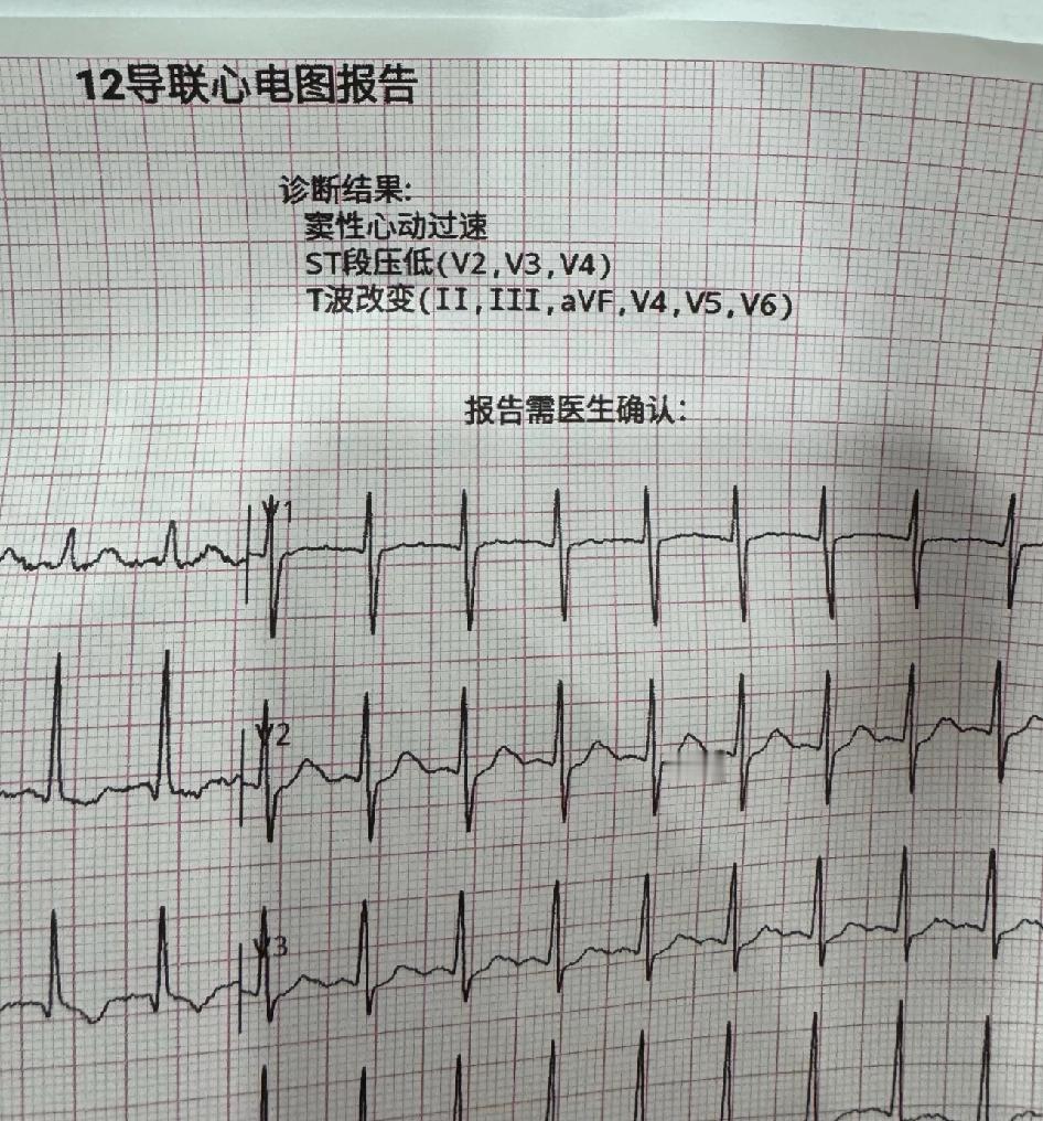 苹果手表还是有点东西的
苹果手表检测的心电图竟然和医院做的心电图诊断一样，以后再