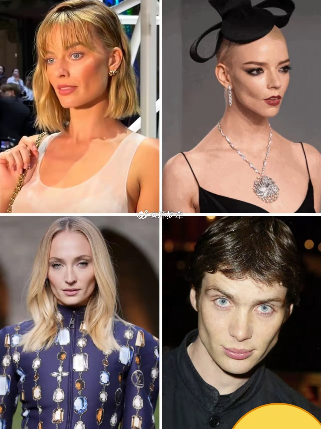 脸颊凹陷or高级脸？欧美顶流最爱的嘬腮手术好看吗 